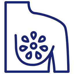 Granülomatöz Mastit